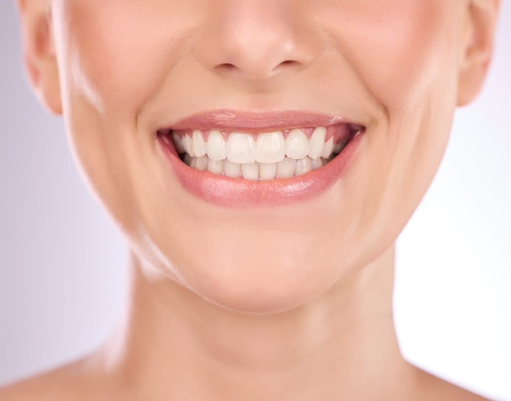Close-up of a woman’s bright, clean white teeth showcasing results of professional teeth whitening treatment in La Mesa – Teeth Whitening La Mesa