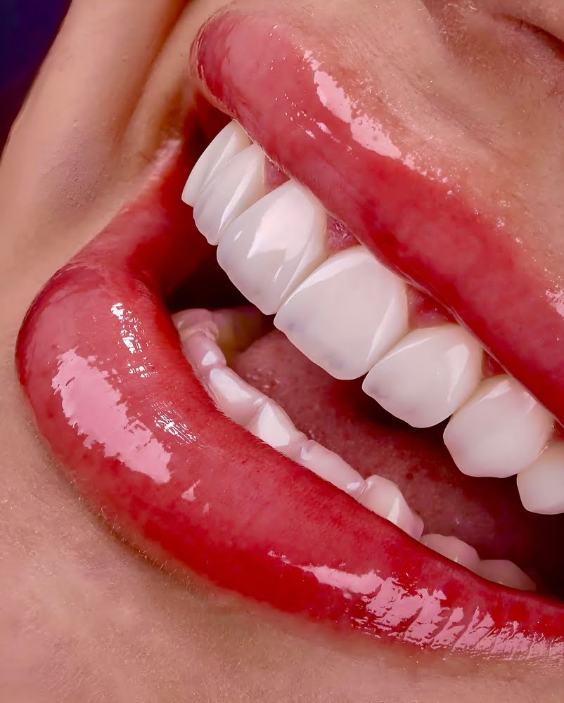 Closeup of beautiful white teeth - Truly Yours Family Dental in La Mesa, CA