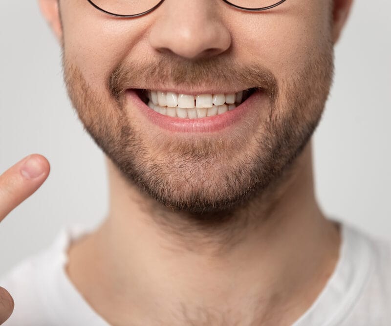How to Fix Crooked Teeth: Braces vs Clear Aligners